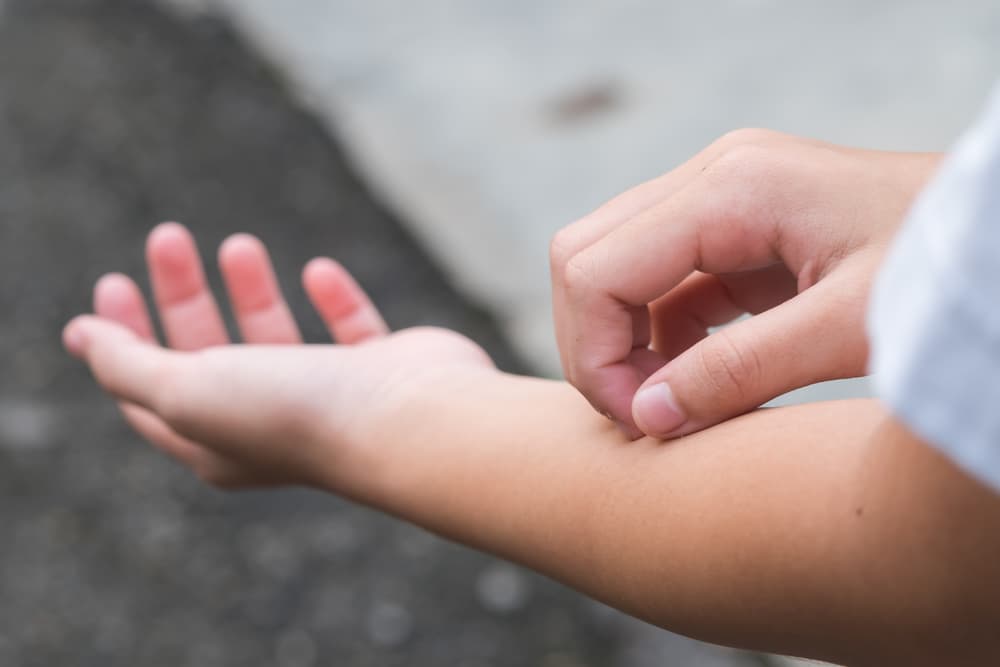 Si tienes comezón constante en la piel, tu cuerpo te está hablando: ¿qué puede significar?