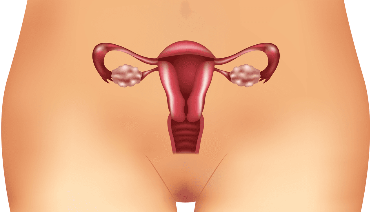 5 síntomas de ovarios poliquísticos que pueden ser fácilmente confundidos