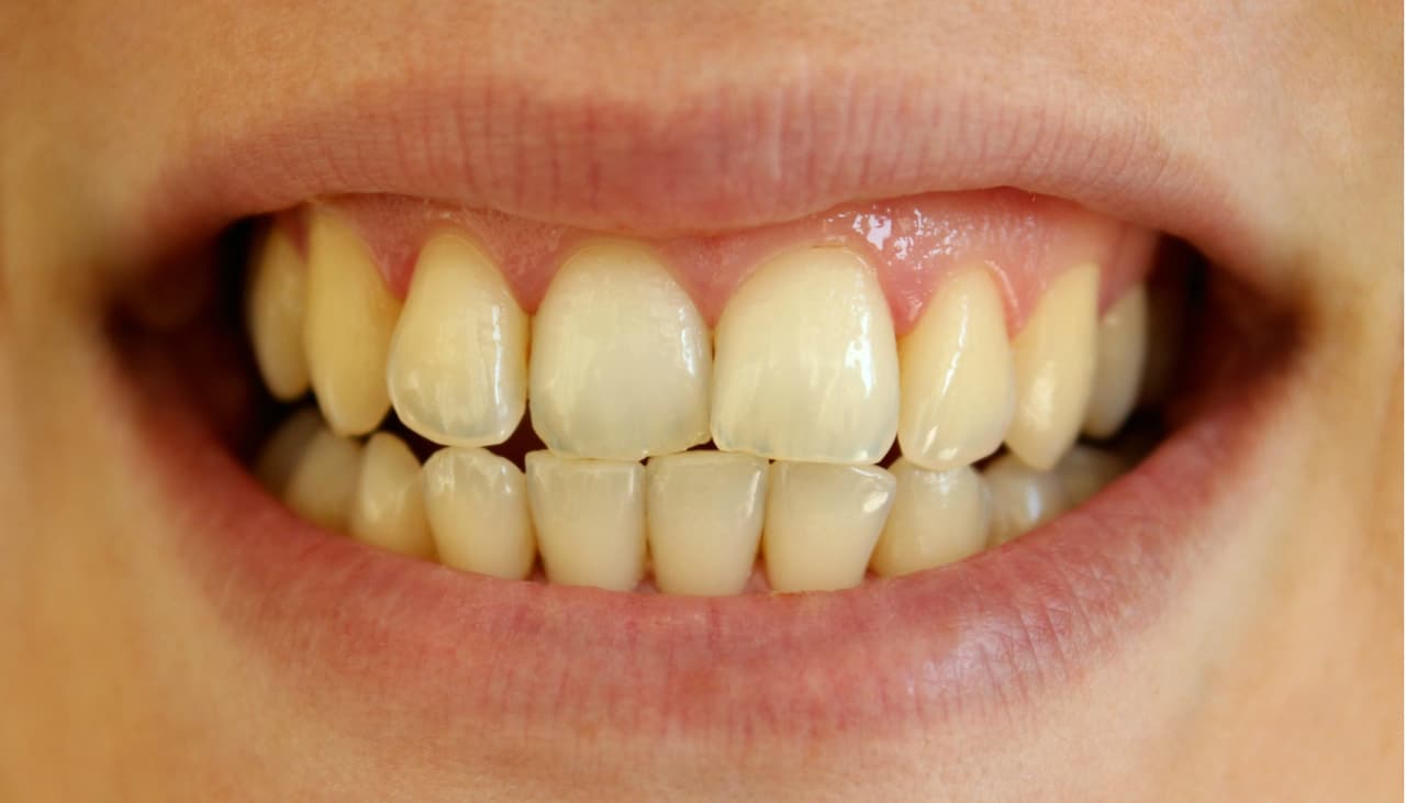 ¿Tomas agua con limón para adelgazar? Tiene un efecto nocivo, según un estudio