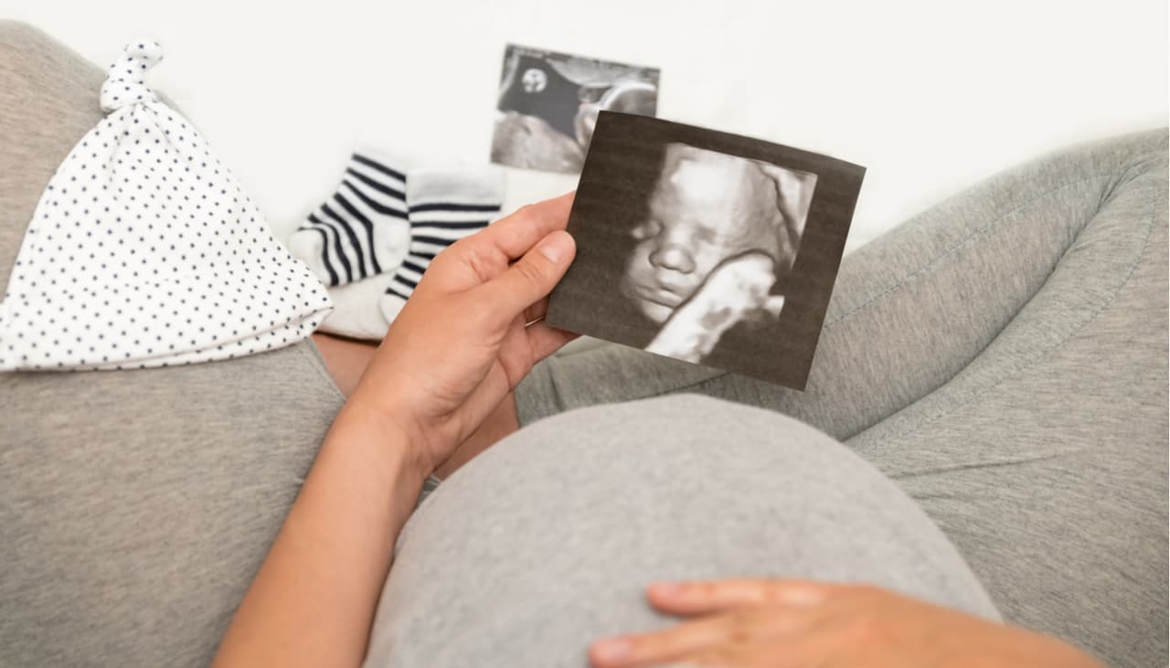Hay 7 tipos de ultrasonido para embarazadas: te explicamos cuáles debes hacerte