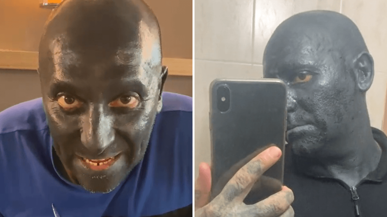 Hombre se tatúa el rostro completo de negro y genera polémica en redes: “¿Para qué?”