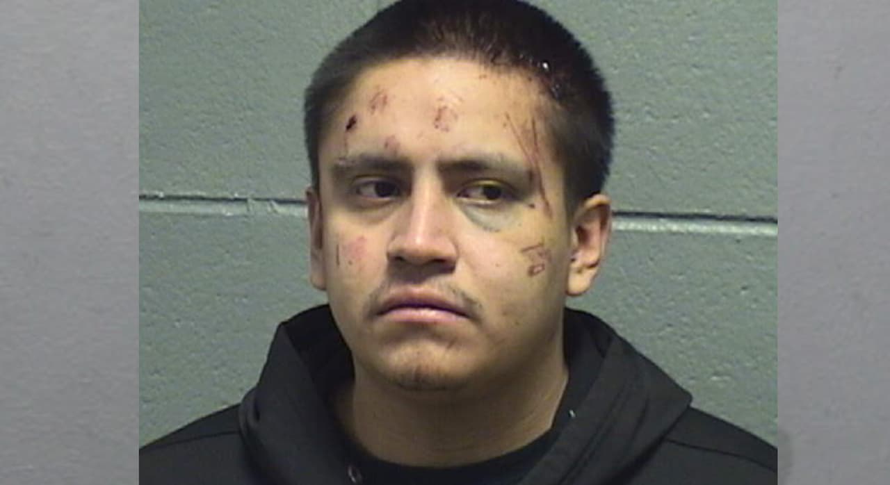 Presunto ladrón es detenido tras ser golpeado con arma con la que intentaba cometer crimen