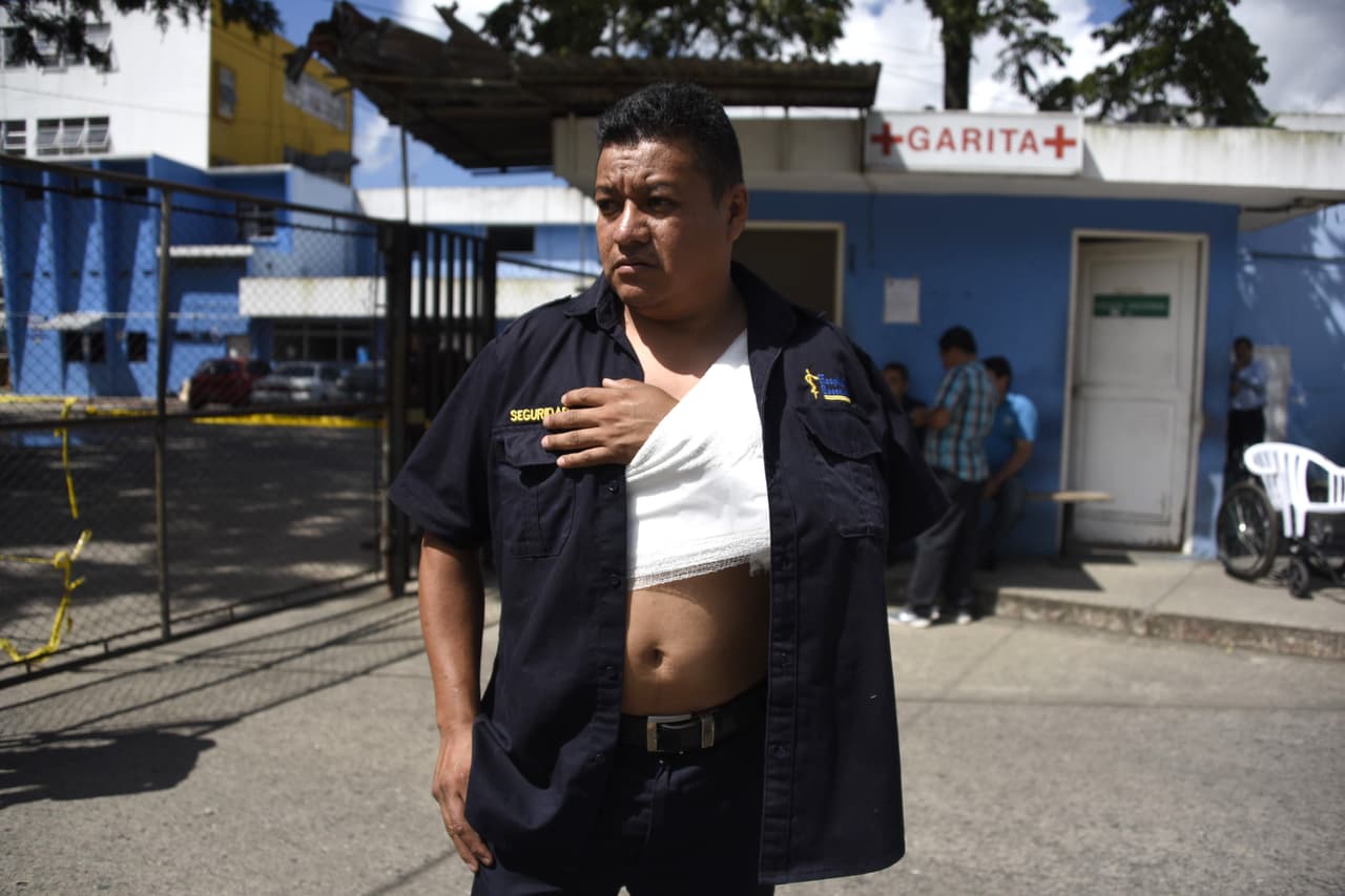 Guatemalan prison guard Giovanni Aju, who was wounded during an attack by presumed gang members, is seen outside the Roosevelt Hospital in Guatemala City on August 16,2017. At least four people were killed and several others wounded when presumed gang members shot dead two prison guards and seriously wounded a third in Guatemala City, raising the toll of policemen killed so far this year to 24, authorities said. Two civilians, including an eight-year-old child, were also killed in the crossfire and several more wounded. / AFP PHOTO / JOHAN ORDONEZ (Photo credit should read JOHAN ORDONEZ/AFP/Getty Images)