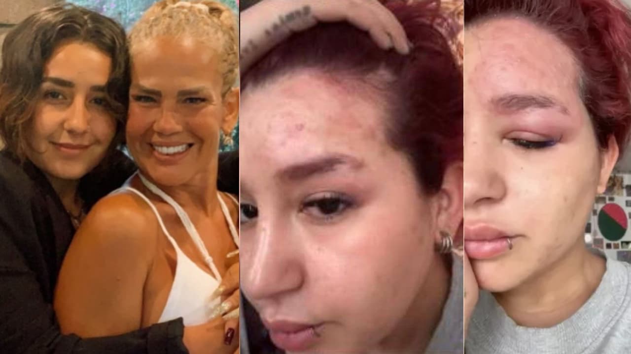 Hija de Niurka aparece ocultando parte de su rostro y narra difícil proceso por enfermedad que sufre