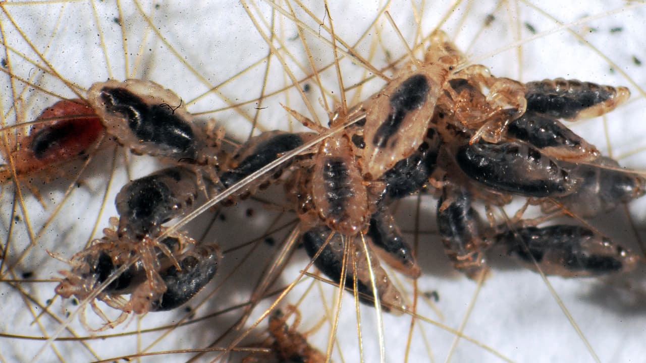 Pediculus humanus capitis es el piojo humano de la cabeza, pediculus humanus corporis es el piojo de la ropa y pthirus pubis es la ladilla o piojo púbico.