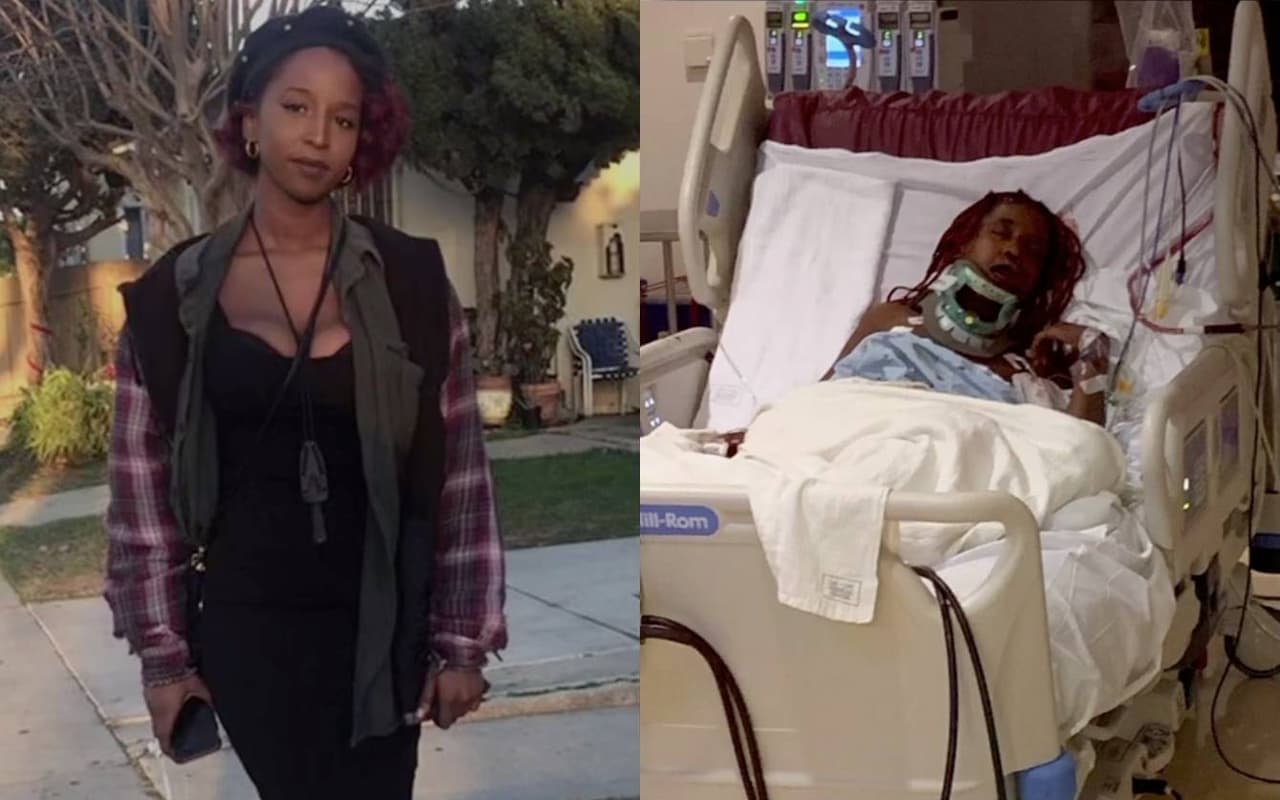 Revelan detalles sobre el incidente que dejó a una mujer con lesiones severas tras ser atropellada