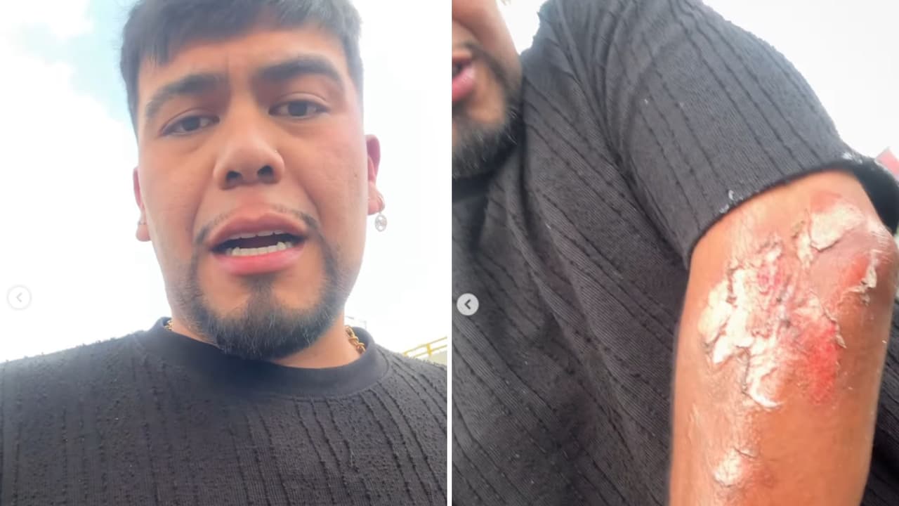 J LU Barber Cervantes compartió cómo se encontraba tras la explosión.