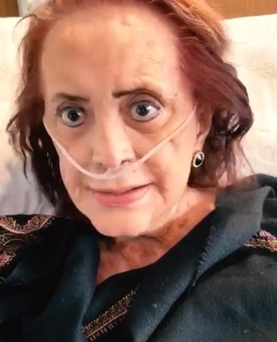 El miércoles 26 de agosto su hija informó, según información del diario
<a href="https://www.eluniversal.com.mx/espectaculos/72-horas-cruciales-para-cecilia-romo" target="_blank">El Universal</a>, que las siguientes 72 horas eran cruciales para la actriz. Romo estaba en hemodiálisis continua y con antibiótico para atacar el hongo.