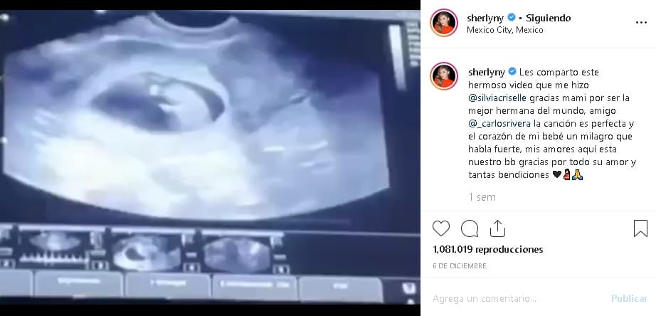 A lo largo de su embarazo hizo partícipes a sus seguidores a través de las redes sociales, donde estuvo compartiendo fotografías y videos del crecimiento de su vientre.
<br>