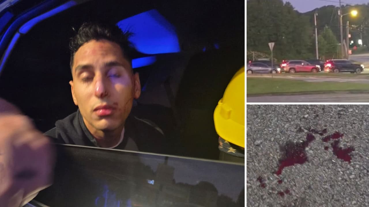 Venezolano denuncia agresión durante detención en Gainesville: terminó con la nariz rota y la boca partida