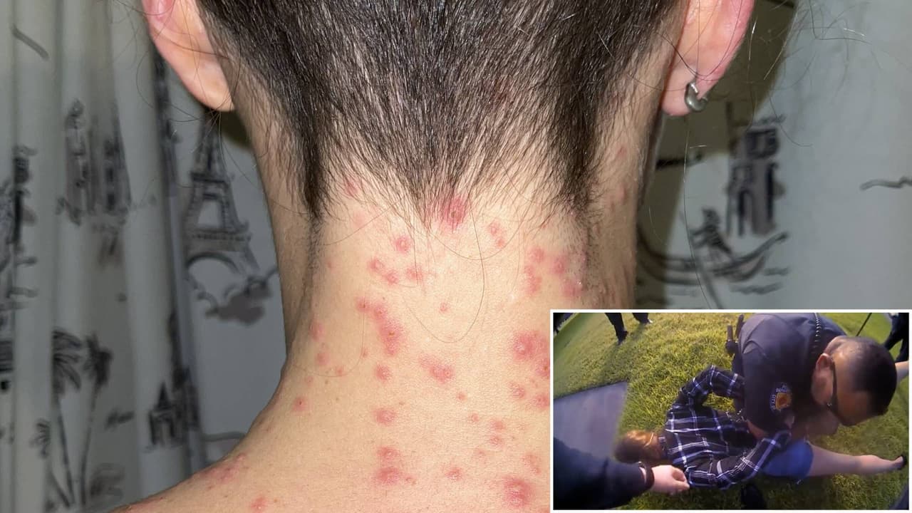 <h2 class="cms-H2-H2">Fue esposada y retenida sobre un hormiguero; corte federal concede inmunidad a policías</h2>
<br>Taylor Rogers fue esposada y detenida sobre un hormiguero, donde los insectos la mordieron al menos 1,000 veces en el rostro y el cuerpo.
<br>La víctima dijo que esto pasó frente a su hijo de 9 años, quien vio todo desde el vehículo.
<br>Presentó una demanda alegando cuatro conductas indebibas durante la detención.
<br>
<a href="https://www.univision.com/local/houston-kxln/corte-federal-concede-inmunidad-policias-santa-fe-isd-mujer-picada-hormigas-arresto">La Corte de Apelaciones del Quinto Circuito de Estados Unidos concedió inmunidad a los dos policías.</a>