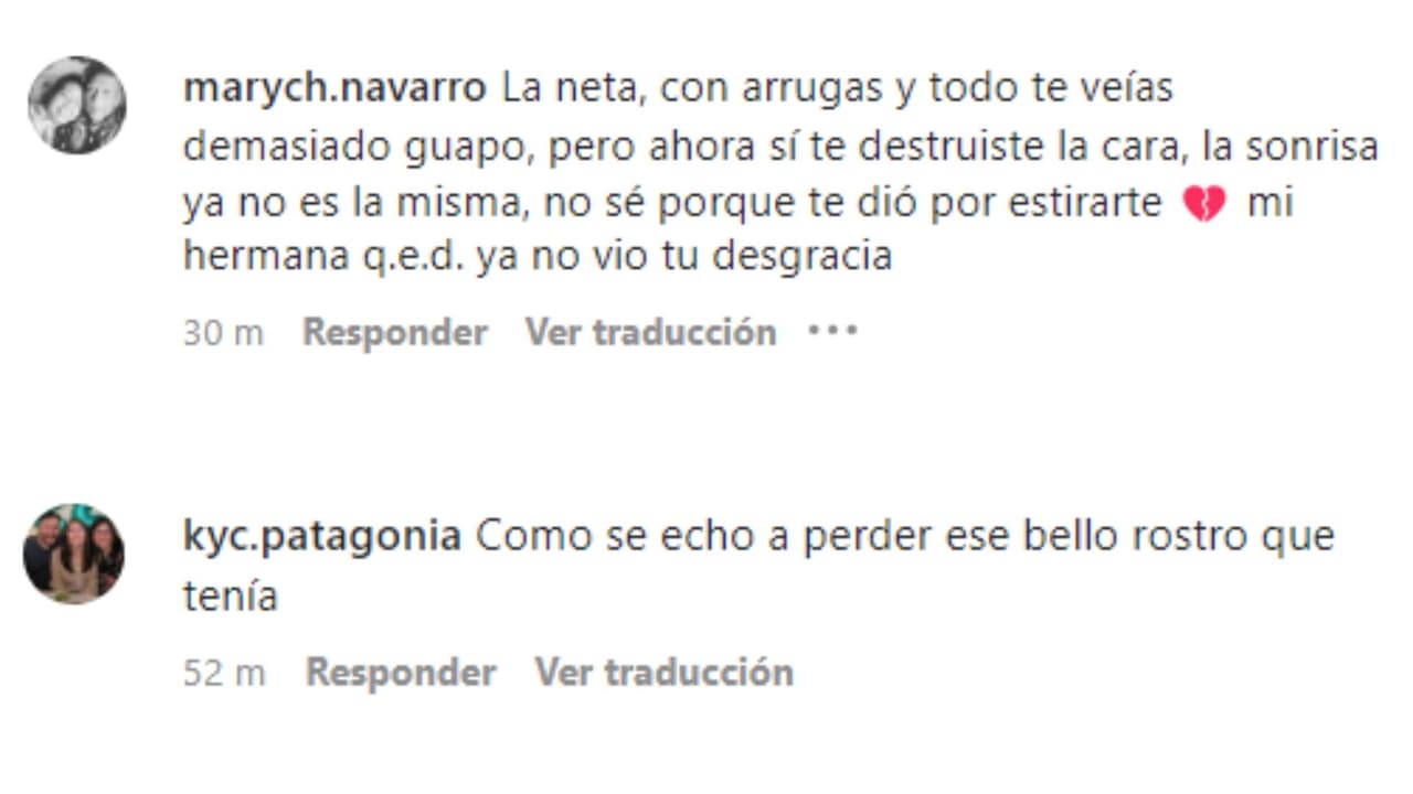 Fans de Chayanne creen que usó bótox y reaccionaron en redes sociales