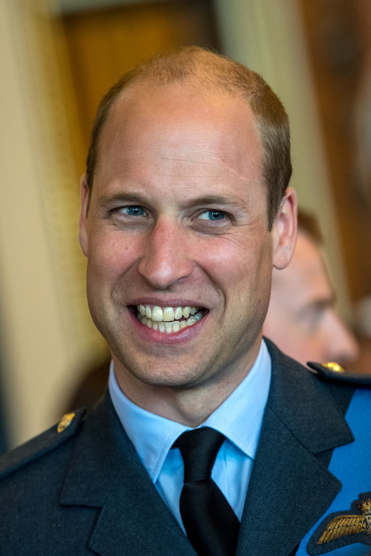 Como si se tratara de una coincidencia romántica, el príncipe William, esposo de Kate, también tiene una cicatriz en la cabeza, resultado de un golpe con un palo de golf cuando tenía 13 años.