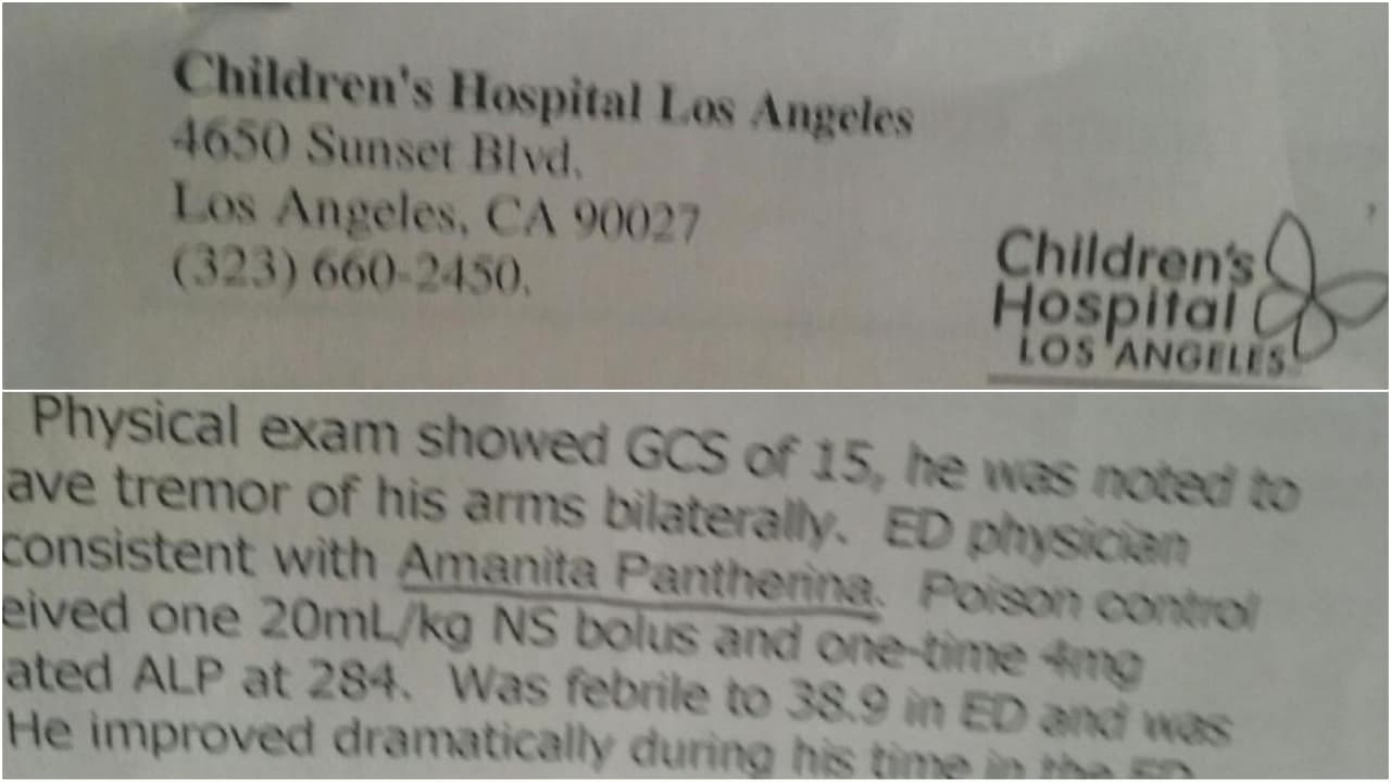 El Children's Hospital confirmó que el tipo de hongos.