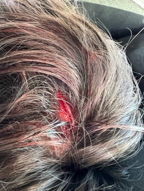 Después del tiroteo y en medio de la confusión, “mi esposo levantó la mano y dijo, el niño está herido de la cabeza”, recordó la madre en medio de lágrimas.