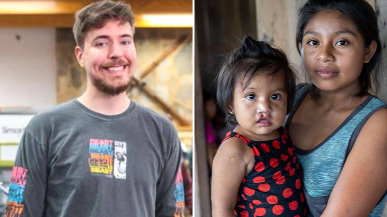 Mr. Beast regala más de 100 cirugías a niños con labio leporino y mexicanos lo llaman "héroe sin capa"