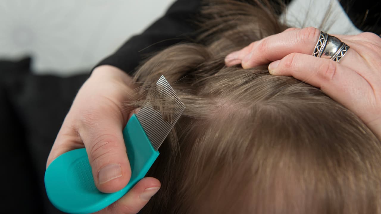 La infestación de piojos se puede tratar con medicamentos que se venden con o sin receta médica en farmacias y supermercados, que tienen ingredientes que matan a estos parásitos.