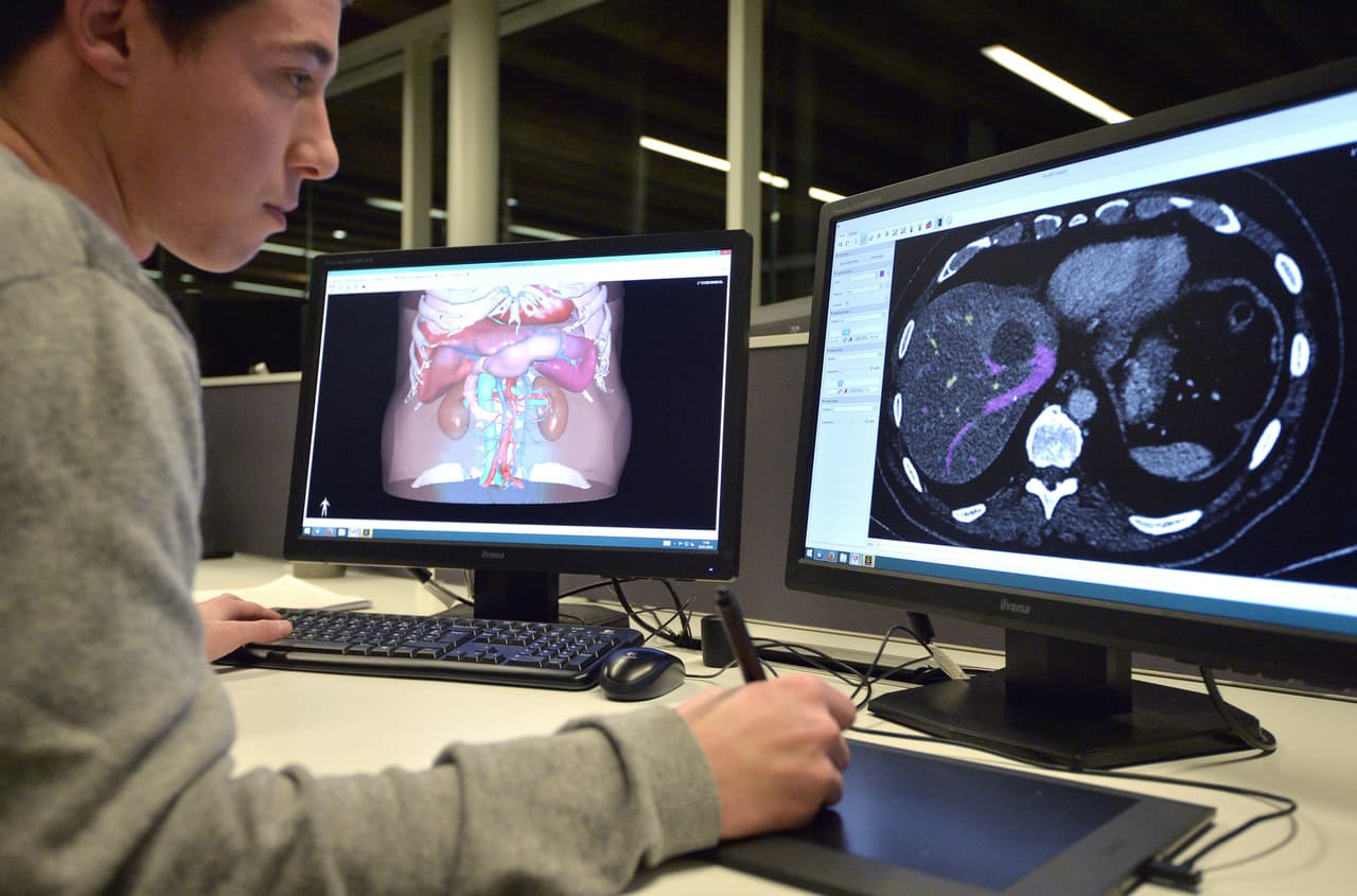 Esta tecnología ayuda a la detección y tratamiento del cáncer de próstata: menos secuelas y más precisión