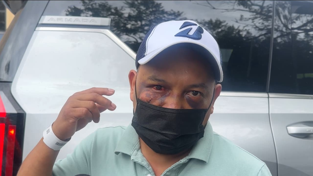 "Voy al hospital": ICE retira grillete a José Mejía que denunció presunta golpiza por parte de agentes en Virginia