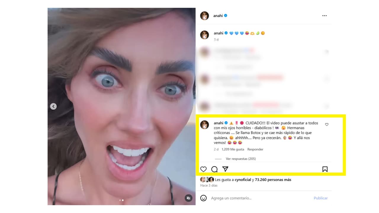 Así respondió Anahí a las constantes críticas por su apariencia física.