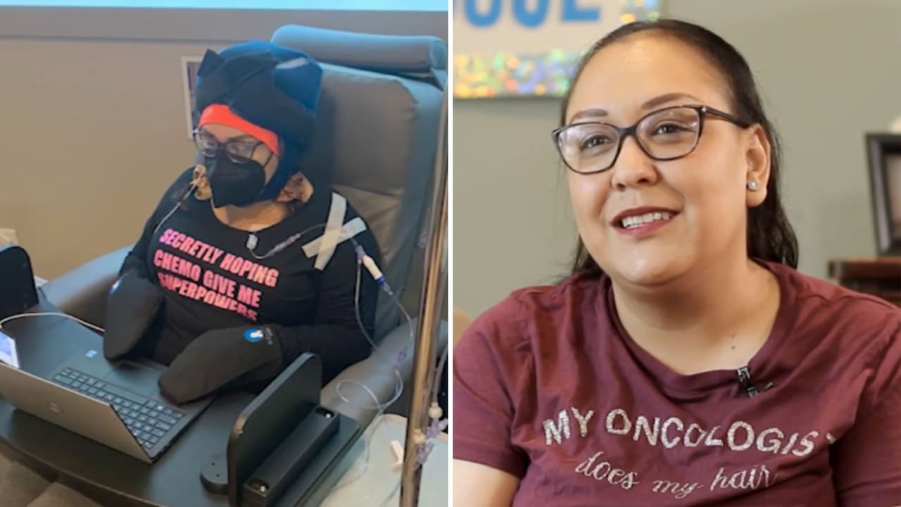 Nuevo tratamiento ayuda a evitar la caída del cabello en pacientes de cáncer