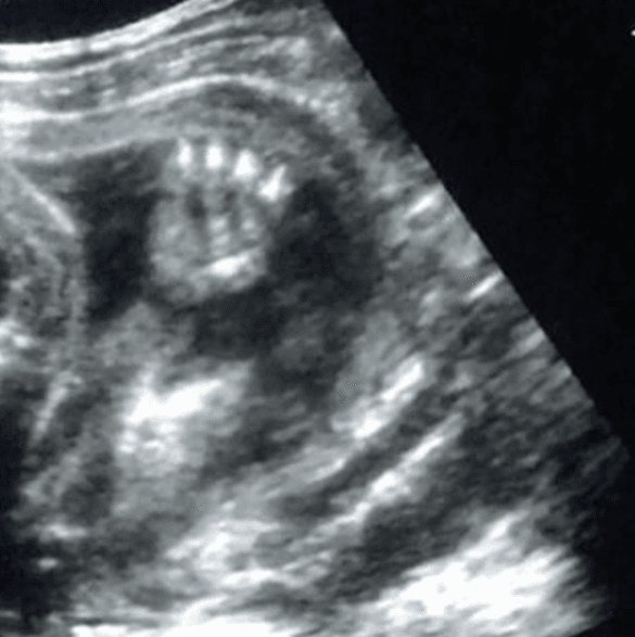 ¡Esta fue su primera foto oficial, qué hermosa manita!