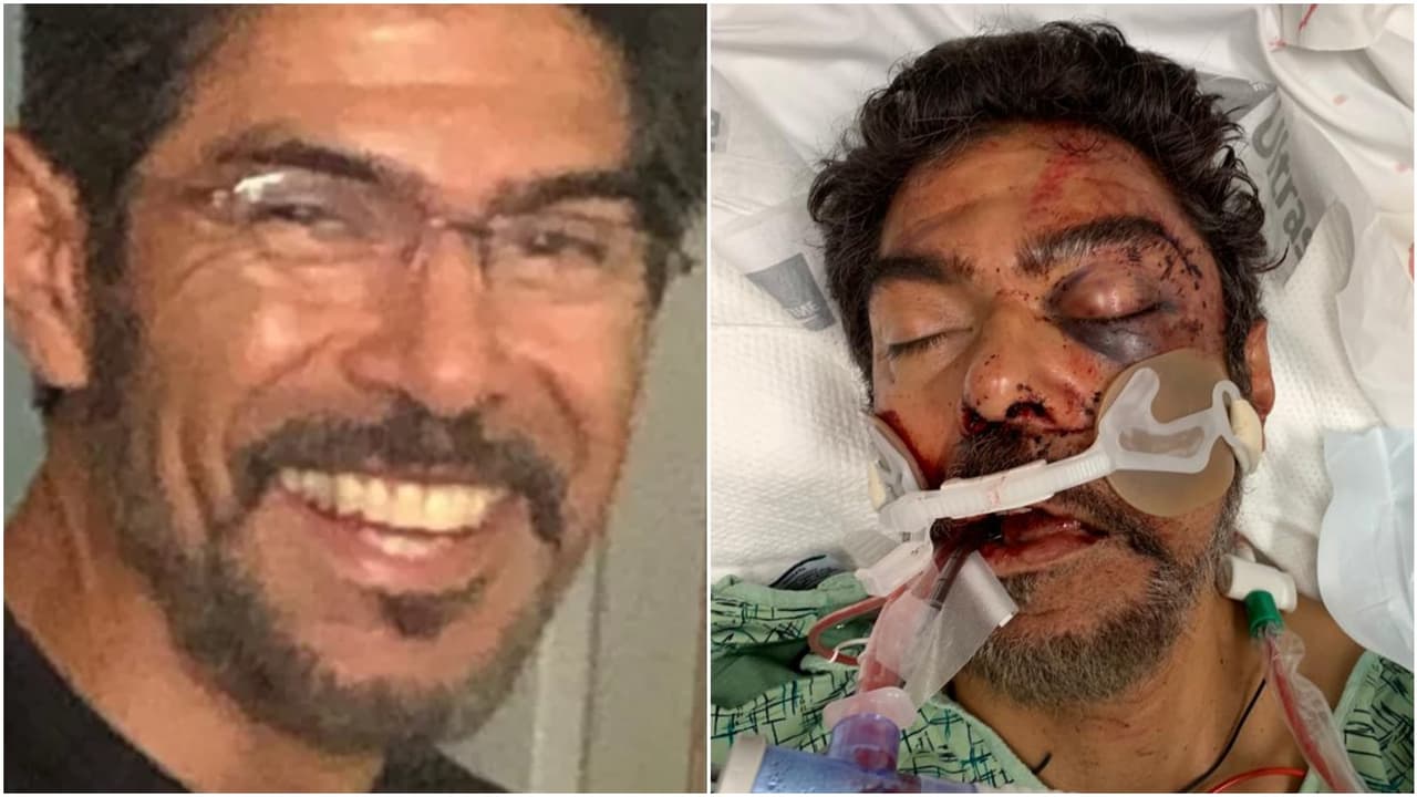 “Sufrió múltiples fracturas en su cara”: sospechosos golpean a padre hispano durante un ‘hit and run’