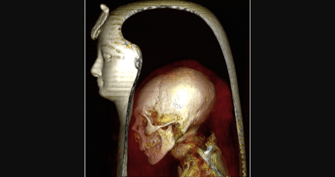 La imagen de TC tridimensional de la cabeza de la momia envuelta de Amenhotep I en una vista lateral izquierda permite la visualización de las capas componentes: la máscara, la cabeza de la momia y los vendajes circundantes.