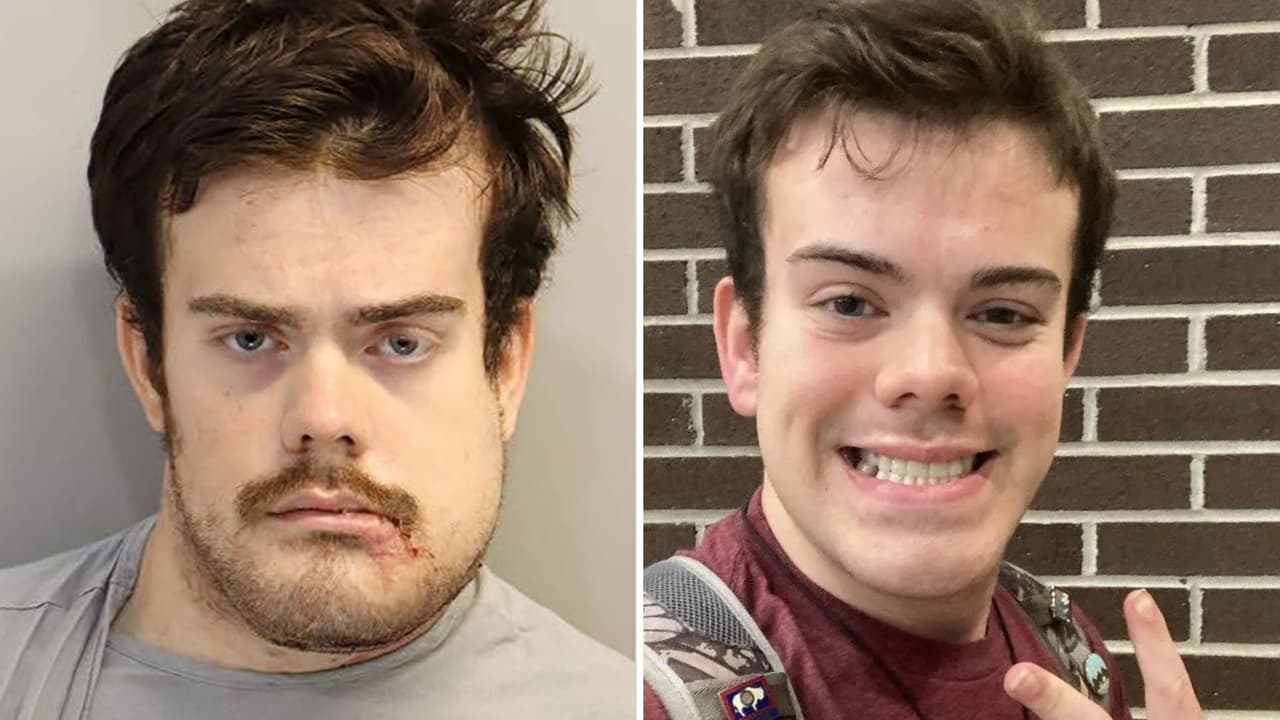 ¿Por qué Phoenix Ikner, el presunto tirador de la Universidad Estatal de Florida, apareció con el rostro desfigurado?