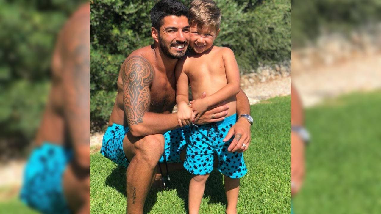 Al parecer, su brazo derecho terminará convertido en 'manga'.