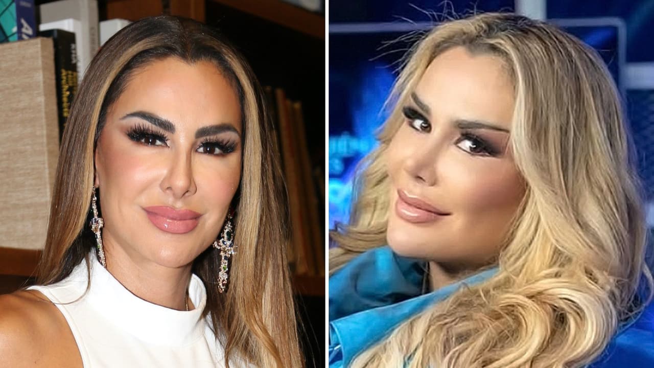 Ninel Conde se someterá a cirugía pese a las fuertes críticas que ha recibido por su aspecto