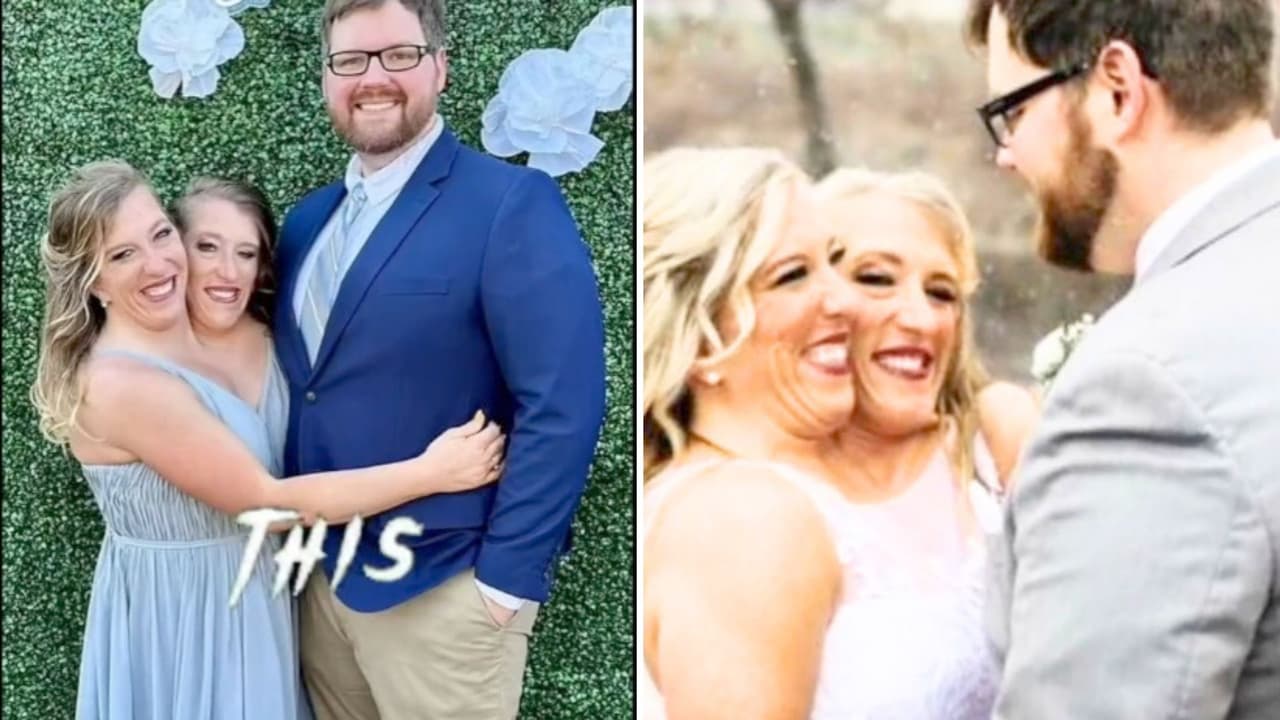 La gemela siamesa Abby Hensel se casó: con una foto de su boda, respondió a las fuertes críticas