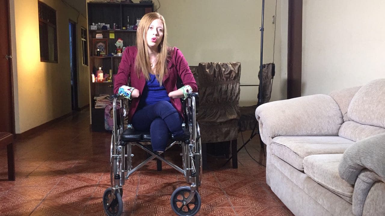 Una bacteria atacó las extremidades de Shirley Meléndez y tuvieron que amputárselas.