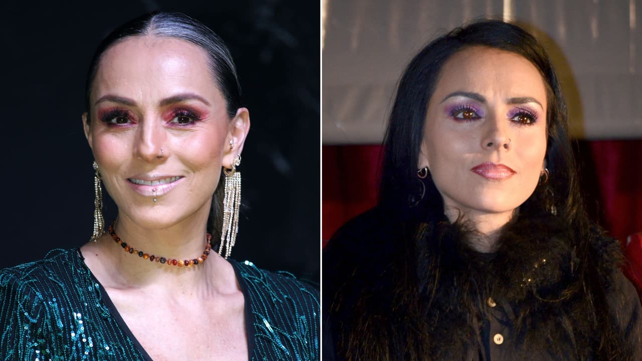Ivonne Montero destapa daño en el rostro como Galilea Montijo: un procedimiento le “pudo provocar una parálisis”