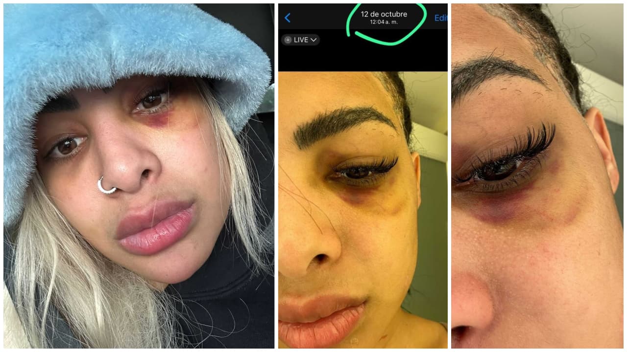 Imágenes de Yailin La Más Viral golpeada difundidas por Santiago Matías Alofoke.