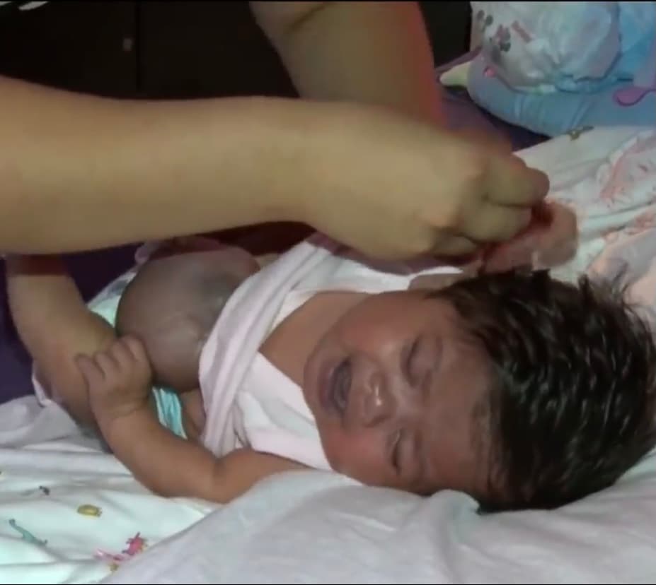 A pesar de esta alentadora noticia, los médicos le insistieron a los padres que no se entusiasmaran tanto, ya que probablemente Marcela
<b>perdería la vida una vez que fuera desconectada del respirador artificial que la había ayudado en sus primeros 42 días. </b>
<br>