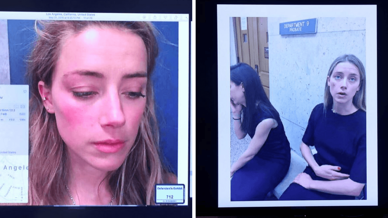 Estas fueron algunas de las pruebas que se mostraron en el juicio donde se asegura que Depp le hizo daño físico a Amber Heard