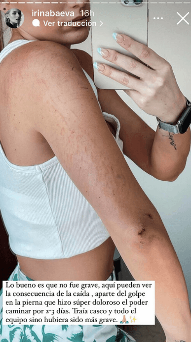 Su caída no tuvo graves consecuencias. No obstante, sí sufrió moretones, raspones y padeció mucho dolor para caminar durante un par de días después del accidente. Además, perdió toda la confianza que tenía, pero con el paso del tiempo logró sobreponerse a la situación.