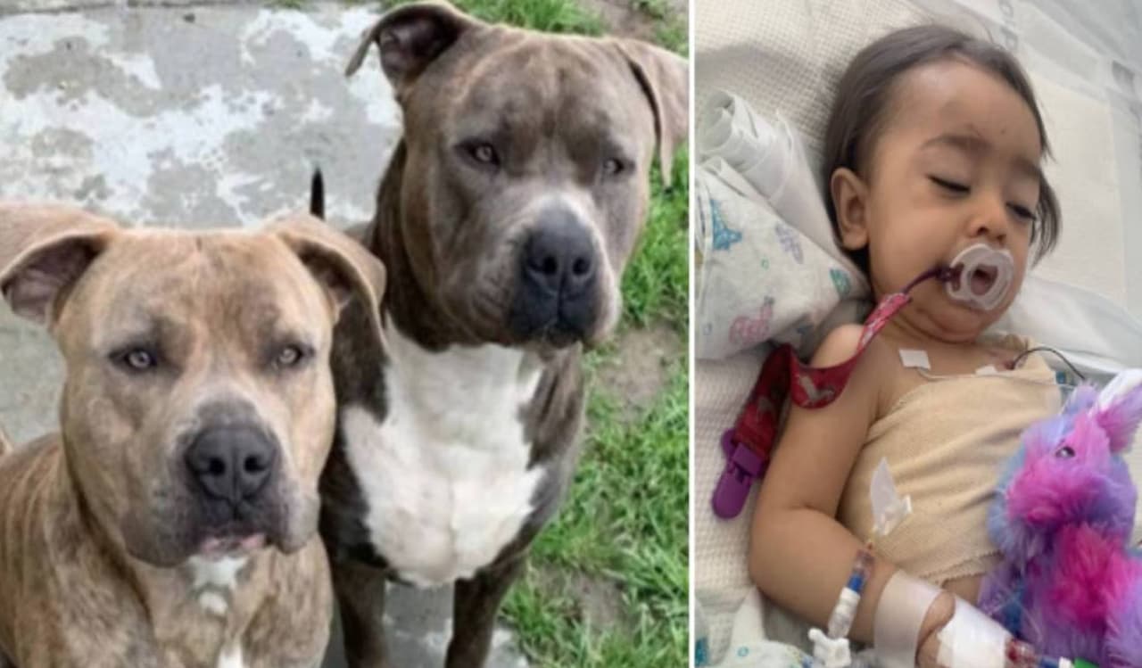 “Sigan rezando por mi nieta. No está fuera de peligro”: abuela de bebé de 1 año atacada por perros pitbull