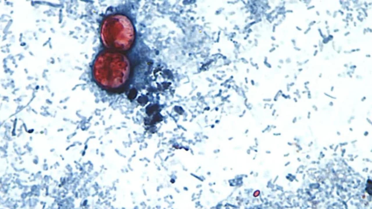 Los CDC alertan sobre un brote de 'diarrea explosiva' causada por ciclosporiasis en California y EEUU: Así puedes prevenirla