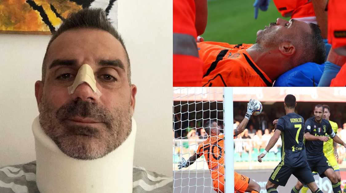 ¡De alto impacto! El portero al que Cristiano noqueó terminó con fractura y cuello ortopédico