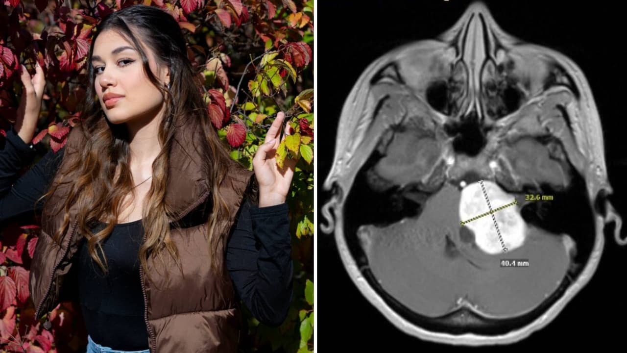 “Pensé que era estrés”: el diagnóstico que recibió Melony Aponte tras años con zumbidos en el oído