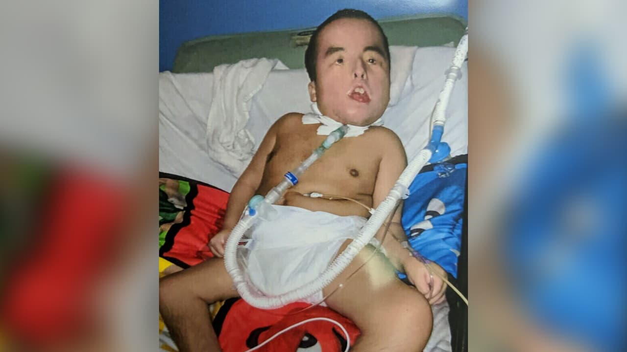 Walter Arriaga, el segundo hijo de María Arriaga, vive conectado a un respirador artifical.