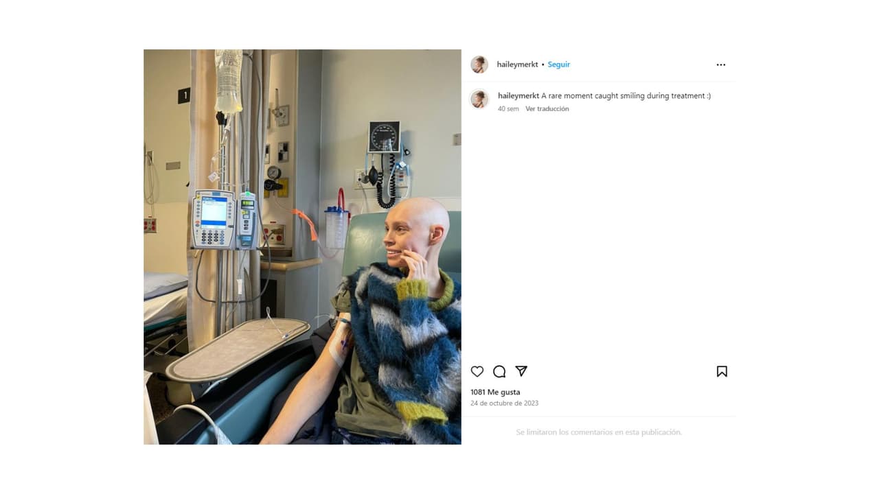 La modelo falleció seis meses después de ser trasplantada.