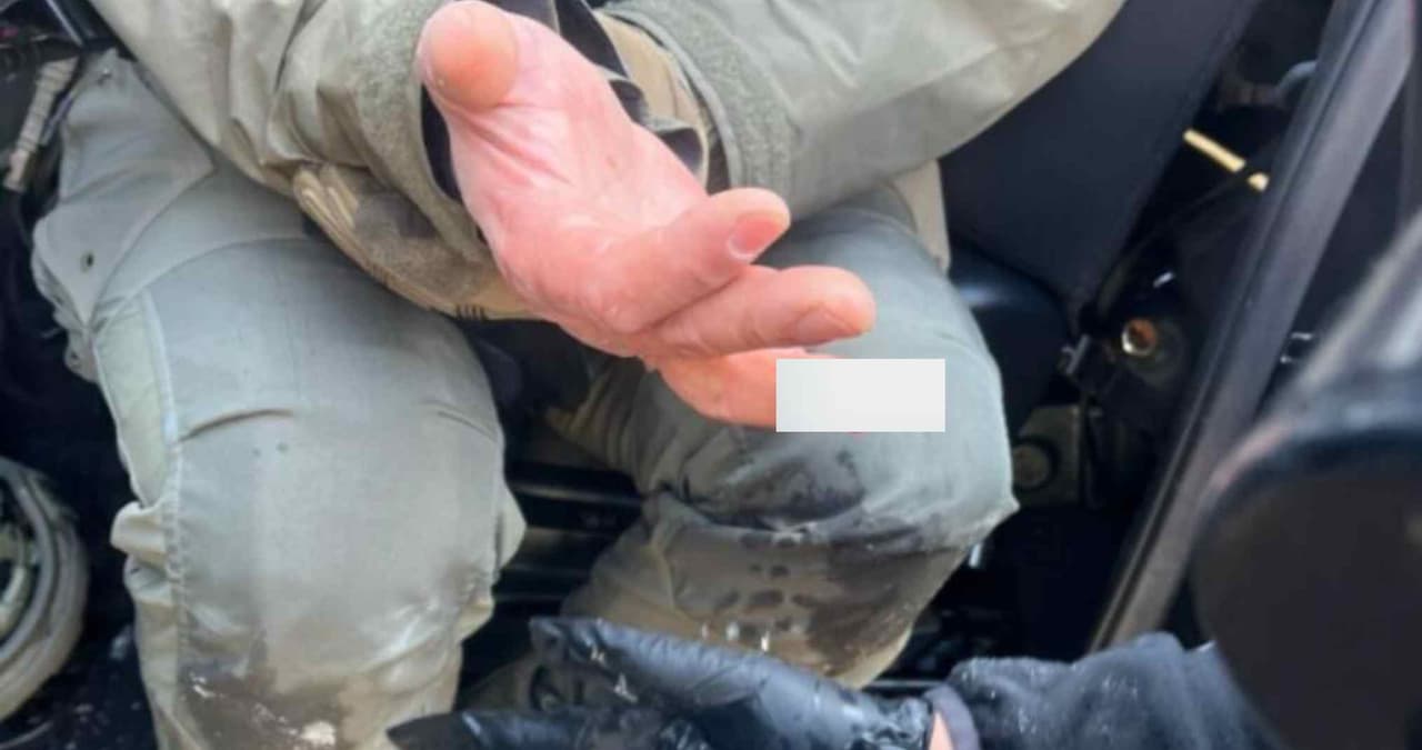 Exhiben a detenidos en Minneapolis y culpan a uno de ellos de arrancarle el dedo a agente federal