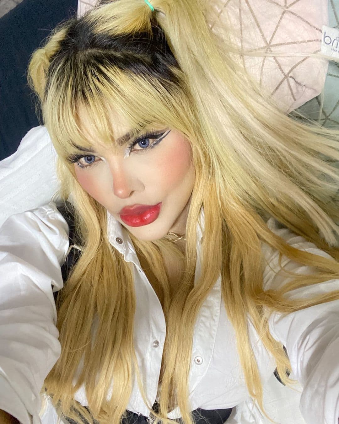 “Tengo 13 levantamientos de ceja, tengo blefaroplastia, tengo tres rinoplastias, tengo una lipopapada, tengo una plastia de labios, que fue una cirugía desafortunada por un encapsulamiento en los labios, dos cambios de prótesis en los senos, lipoescultura”, resumió según recordaba.