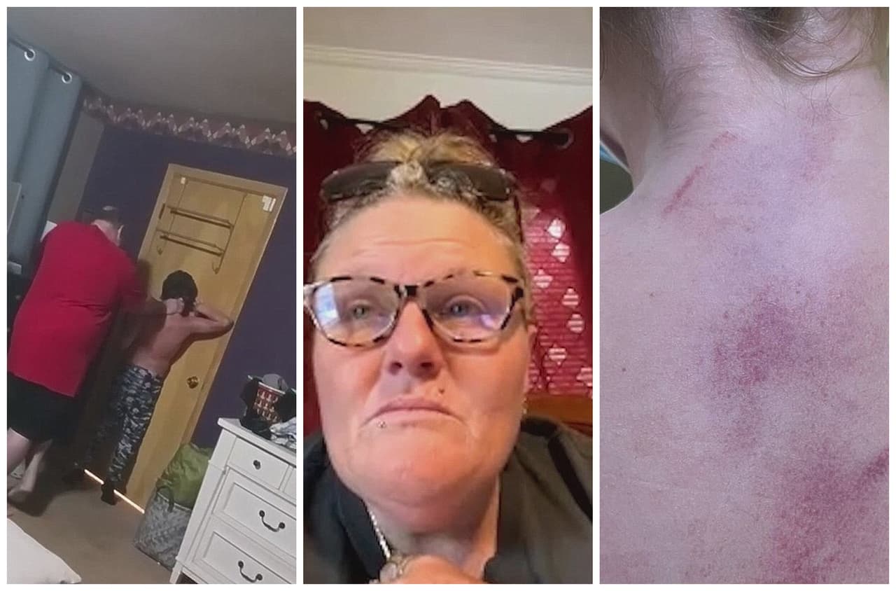 Madre hispana denuncia que el padre adoptivo de sus hijos golpeó a uno de ellos