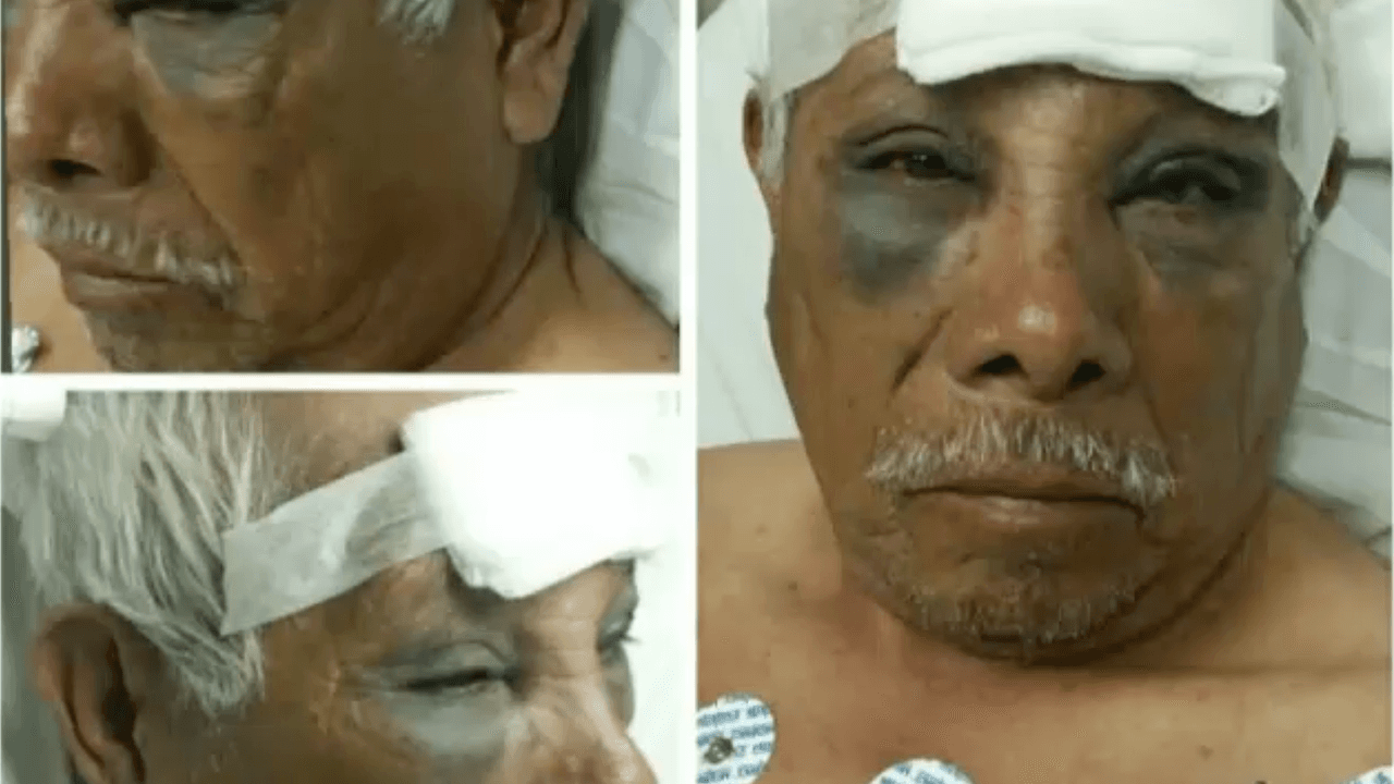 Paletero hispano de 71 años fue el blanco de un brutal asalto en Los Ángeles