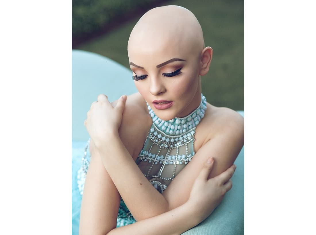 Para esta sesión de fotos, Andrea tuvo la valentía de dejarse ver sin su peluca