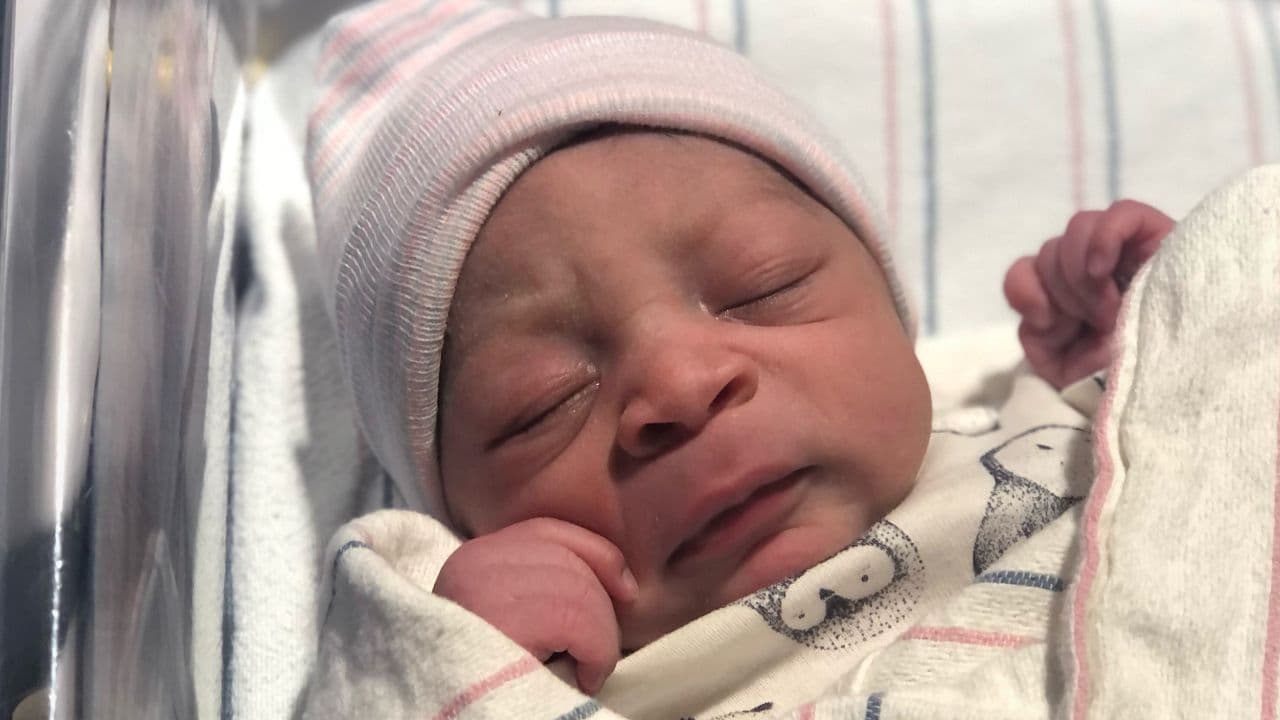 Así se veía Hezekiah Hope, quien nació en el hospital Duke University.